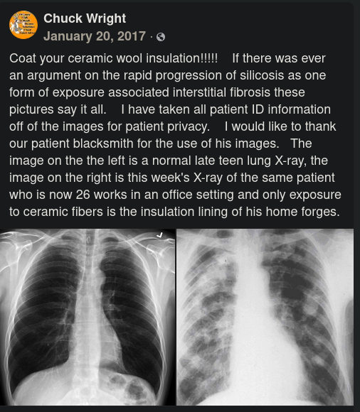 A Facebook post by Chuck Wright from 20 January 2017. It contains two chest X-rays side by side. The text reads: “Coat your ceramic wool insulation!!!!! If there was ever an argument on the rapid progression of silicosis as one form of exposure associated interstitial fibrosis these pictures say it all. I have taken all patient ID information off of the images for patient privacy. I would like to thank our patient blacksmith for the use of his images. The image on the the left is a normal late teen lung X-ray, the image on the right is this weeks X-ray of the same patient who is now 26 works in an office setting and only exposure to ceramic fibers is the insulation lining of his home forges.